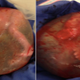 Illustration for article titled Rare Images Of A Baby Born While Still Inside The Amniotic Sac